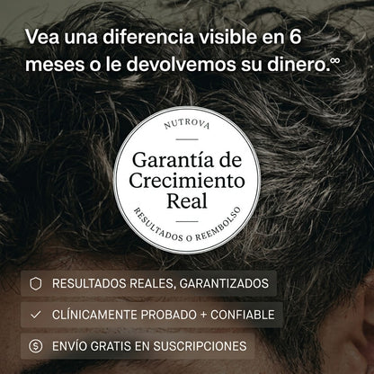 NUTROVA® | Fórmula Capilar para Hombre con Capixyl™ — Gotero 30ml
